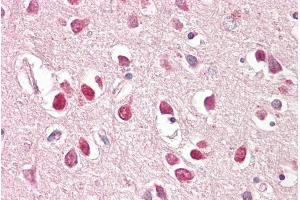 ABIN184627 (3. (BAIAP2 antibody  (C-Term))