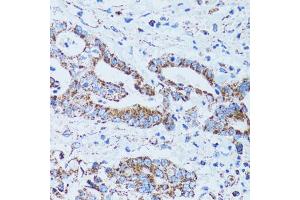 Immunohistochemistry of paraffin-embedded human colon carcinoma using GIP antibody (ABIN1882357) at dilution of 1:100 (40x lens). (GIP antibody)