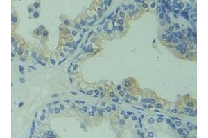 Detection of CAPS in Human Prostate Tissue using Polyclonal Antibody to Calcyphosine (CAPS) (Calcyphosine antibody  (AA 1-189))