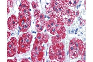 Anti-CAD antibody IHC of human adrenal. (CAD antibody  (AA 1625-1900))