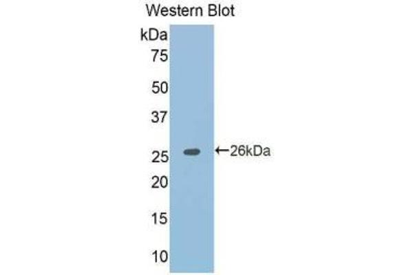 TNFRSF21 antibody  (AA 406-605)