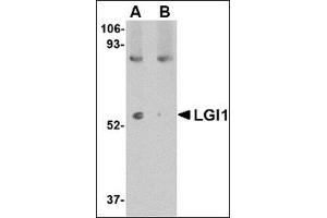 Western blot analysis of LGI1 in mouse brain tissue lysate with this product at 1 μg/ml in (A) the absence and (B) the presence of blocking peptide. (LGI1 antibody  (N-Term))