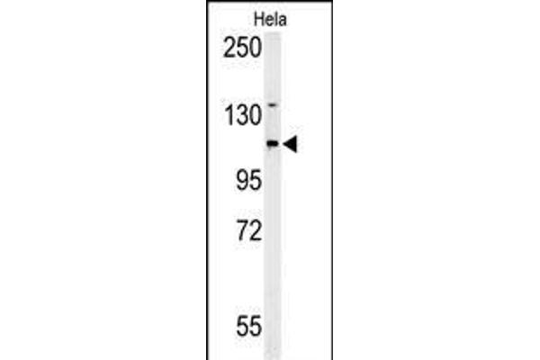 ADCY4 antibody  (AA 415-441)