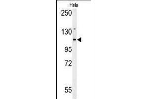 Western blot analysis of ADCY4 Antibody (Center)&65288,Cat(ABIN653832 and ABIN2843098)) in Hela cell line lysates (35 μg/lane).