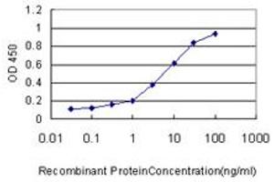 Detection limit for recombinant GST tagged TOLLIP is approximately 1ng/ml as a capture antibody. (TOLLIP antibody  (AA 1-274))