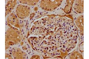 IHC image of ABIN7175242 diluted at 1:500 and staining in paraffin-embedded human kidney tissue performed on a Leica BondTM system. (ATP6VD2 (AA 50-295) antibody)