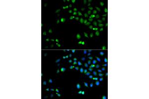 Immunofluorescence analysis of A549 cells using HOXA1 antibody (ABIN5974165).