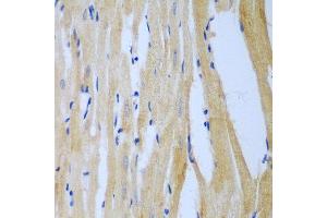 Immunohistochemistry of paraffin-embedded rat heart using MGAT3 antibody at dilution of 1:100 (40x lens).