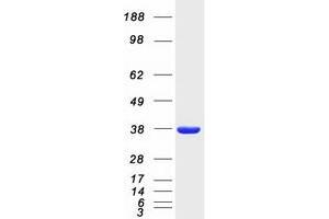 Western Blotting (WB) image for Butyrophilin, Subfamily 3, Member A2 (BTN3A2) protein (Myc-DYKDDDDK Tag) (ABIN2715355)
