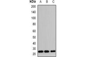 Western blot analysis of TP53INP2 expression in HeLa (A), RAW264. (TP53INP2 antibody  (N-Term))