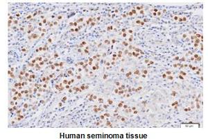 Paraffin embedded sections of human seminoma tissue were incubated with anti-human Nanog (1:50) for 2 hours at room temperature. (Nanog antibody  (AA 1-154))