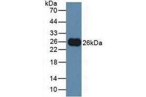 Detection of TIGIT in Rat Serum using Polyclonal Antibody to T-Cell Immunoreceptor With Ig And ITIM Domains Protein (TIGIT) (TIGIT antibody  (AA 28-227))