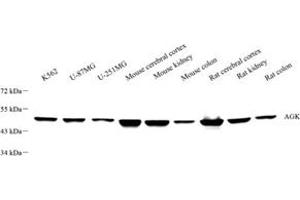 Western blot analysis of AcylglycerolKinase (ABIN7072938) at dilution of 1: 500 (Acylglycerol Kinase antibody)