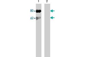 Western blot of Jurkat cells stimulated with calyculin A (100 nM, 30 min) (lane 1) followed by lambda phosphatase (lane 2) treatment. (DOK1 antibody  (pSer450))