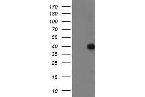 HEK293T cells were transfected with the pCMV6-ENTRY control (Left lane) or pCMV6-ENTRY ANKRD53 (Right lane) cDNA for 48 hrs and lysed. (ANKRD53 antibody  (AA 1-300))