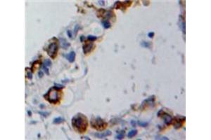 Used in DAB staining on fromalin fixed paraffin-embedded Ovary tissue (Cofilin 2 antibody  (AA 1-156))
