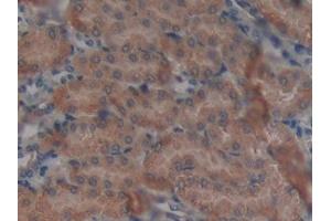 DAB staining on IHC-P; Samples: Mouse Kidney Tissue (GALNS antibody  (AA 168-377))