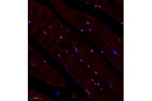 Immunofluorescence of paraffin embedded rat skeletal muscle using BCMA (ABIN7076067) at dilution of 1: 600 (250x lens) (BCMA antibody)