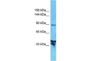 Host:  Rabbit  Target Name:  AXIN2  Sample Type:  Jurkat Whole Cell lysates  Antibody Dilution:  1. (AXIN2 antibody  (N-Term))
