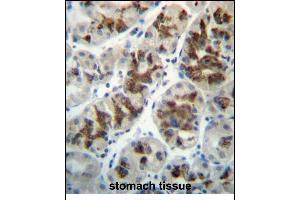 Immunohistochemistry (Paraffin-embedded Sections) (IHC (p)) image for anti-Connective Tissue Growth Factor (CTGF) (AA 166-193) antibody (ABIN657322)