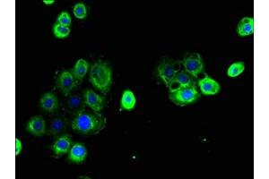 Immunofluorescent analysis of A431 cells using ABIN7147867 at dilution of 1:100 and Alexa Fluor 488-congugated AffiniPure Goat Anti-Rabbit IgG(H+L) (Claudin 15 antibody  (AA 72-128))