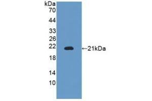 Detection of Recombinant ITGaM, Mouse using Polyclonal Antibody to Integrin Alpha M (CD11b) (CD11b antibody  (AA 248-430))