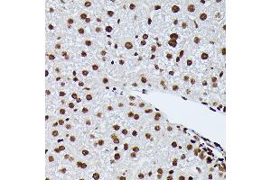 Immunohistochemistry of paraffin-embedded mouse liver using Phospho-NRF2-S40 Rabbit mAb (ABIN7268970) at dilution of 1:100 (40x lens). (NRF2 antibody  (pSer40))