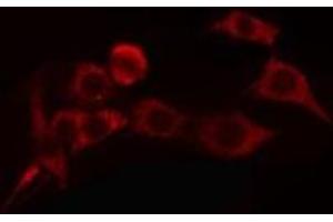 ABIN6275813 staining COLO205 cells by IF/ICC. (Cytochrome P450 4A11/22 antibody)