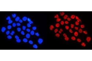 IF analysis of HnRNP A1 using anti-HnRNP A1 antibody (ABIN4886621).