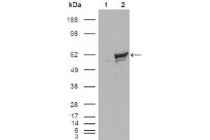 Western blot analysis using CHK1 mouse mAb against HEK293T cells transfected with the pCMV6-ENTRY control (1) and pCMV6-ENTRY CHK1 cDNA (2). (CHEK1 antibody)