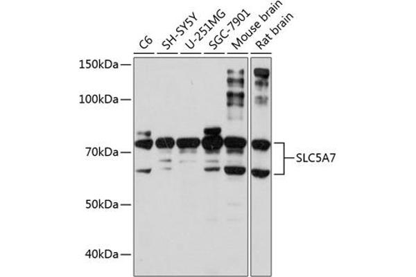 ChT 抗体  (AA 421-580)
