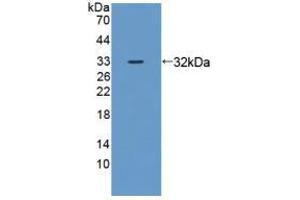 Figure. (DNAJC2 antibody  (AA 368-621))