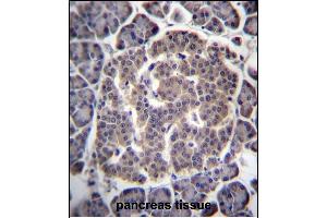 UGCGL1 Antibody (C-term) (ABIN657069 and ABIN2846232) immunohistochemistry analysis in formalin fixed and paraffin embedded human pancreas tissue followed by peroxidase conjugation of the secondary antibody and DAB staining.