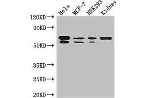 Western Blot Positive WB detected in: Hela whole cell lysate, MCF-7 whole cell lysate, HEK293 whole cell lysate, Mouse kidney tissue All lanes: RBPJ antibody at 3. (RBPJ antibody  (AA 243-485))