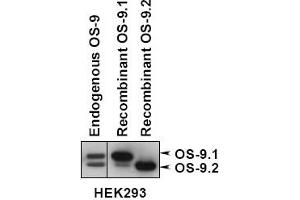 Western blot analysis of OS9 in lysates of 293 cells expressing OS-9. (OS9 antibody  (AA 300-400))
