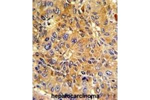 Immunohistochemistry (IHC) image for anti-Cyclin A2 (CCNA2) antibody (ABIN3003117) (Cyclin A antibody)