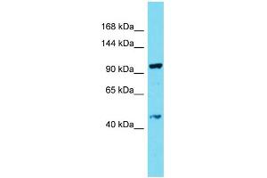 Host: Rabbit Target Name: CCDC135 Sample Type: THP-1 Whole Cell lysates Antibody Dilution: 1. (CCDC135 antibody  (C-Term))