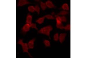 ABIN6269180 staining COS7 by IF/ICC. (Phospholipase C gamma 1 antibody)