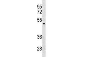NEU1 antibody western blot analysis in HepG2 lysate. (NEU1 antibody  (AA 188-214))
