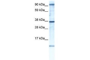 WB Suggested Anti-AKAP7 Antibody Titration:  0. (AKAP7 antibody  (N-Term))