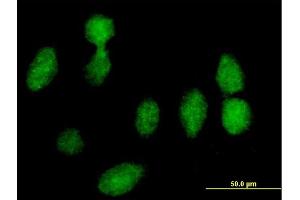 Immunofluorescence of purified MaxPab antibody to RPLP0 on HeLa cell. (RPLP0 antibody  (AA 1-317))