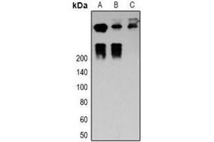 Western blot analysis of Desmoplakin expression in MCF7 (A), Hela (B), mouse heart (C) whole cell lysates. (Desmoplakin antibody)