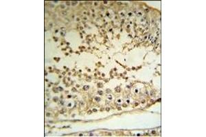 PE Antibody (C-term) (R) IHC analysis in forlin fixed and paraffin embedded hun testis tissue followed by peroxidase conjugation of the secondary antibody and DAB staining. (PRAME antibody  (C-Term))