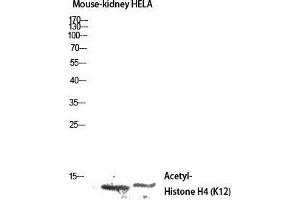 Western Blot (WB) analysis of Mouse Kidney HeLa lysis using Acetyl-Histone H4 (K12) antibody.