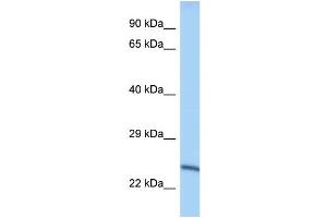WB Suggested Anti-Mettl10 Antibody Titration: 1. (METTL10 antibody  (Middle Region))
