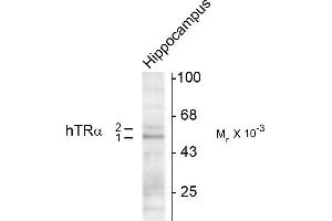 Western blots of hippocampal lysate showing specific immunolabeling of the ~50k TR-a1 and the ~58k TR-a2 protein. (THRA antibody  (N-Term))