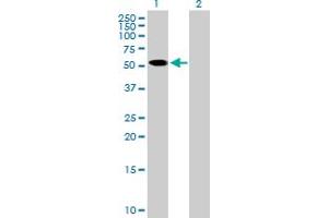 Western Blot analysis of ZNF410 expression in transfected 293T cell line by ZNF410 MaxPab polyclonal antibody. (ZNF410 antibody  (AA 1-478))