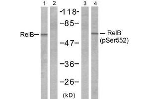 Western blot analysis of extracts from A431 cells, untreated or treated with EGF (200ng/ml 10min), using RelB (Ab-552) antibody (E021247, Line 1 and 2) and RelB (phospho- Ser552) antibody (E011255, Line 3 and 4). (RELB antibody  (pSer552))