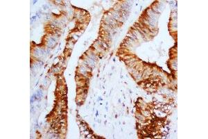 Immunohistochemistry (IHC) image for anti-Mitogen-Activated Protein Kinase 1/3 (MAPK1/3) (N-Term) antibody (ABIN3031825)