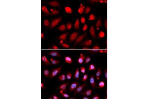Immunofluorescence analysis of U2OS cells using EZH2/KMT6 antibody (ABIN6133509, ABIN6140393, ABIN6140396 and ABIN6215059). (EZH2 antibody  (AA 1-250))